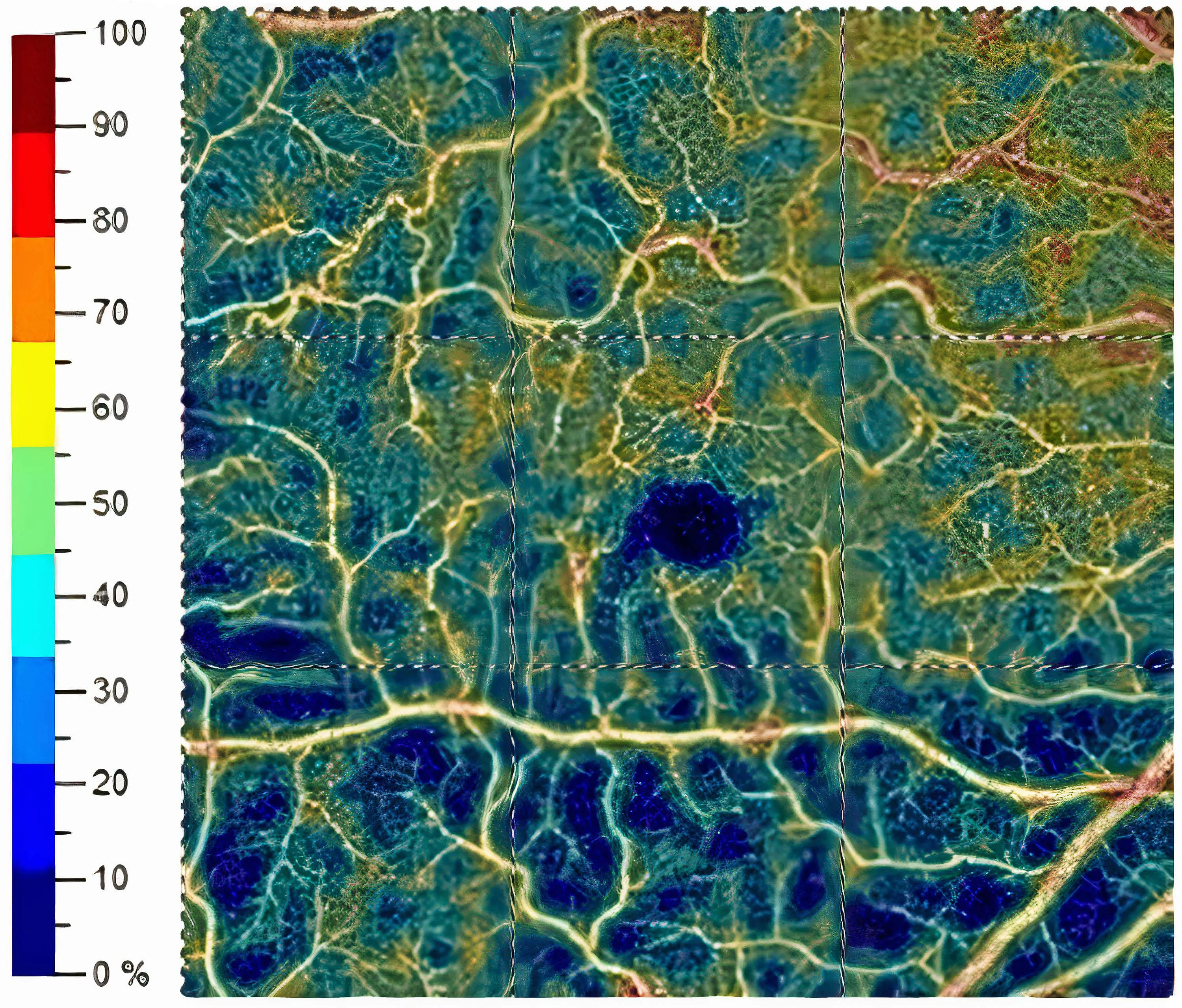 Cartographie de la densit&eacute; vasculaire de la macula en OCTA