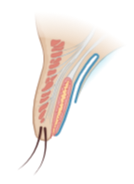 Anatomie d'une paupière : muscle releveur, tarse, conjonctive, glandes de Meibomius