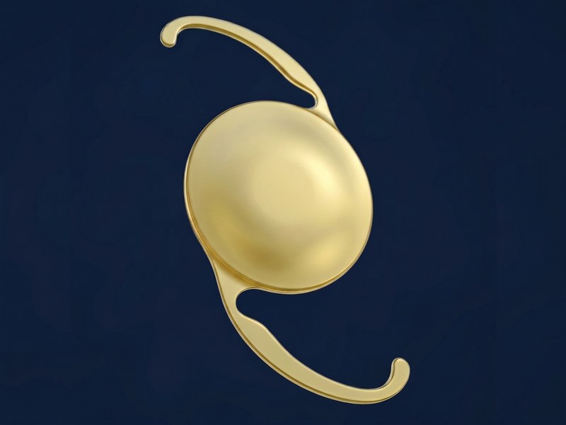 Implant intraoculaire EDOF : optique à profondeur de champ étendue, surface lisse dépourvue d'anneaux diffractifs, haptiques en C
