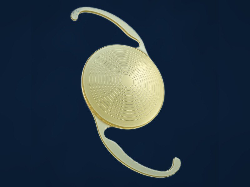 Implant intraoculaire multifocal trifocal : anneaux diffractifs concentriques gravés sur l'optique pour créer trois foyers, haptiques en C