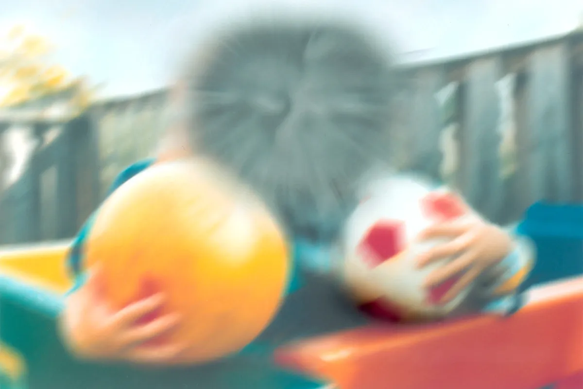 Simulation de la vision avec une DMLA montrant un scotome central