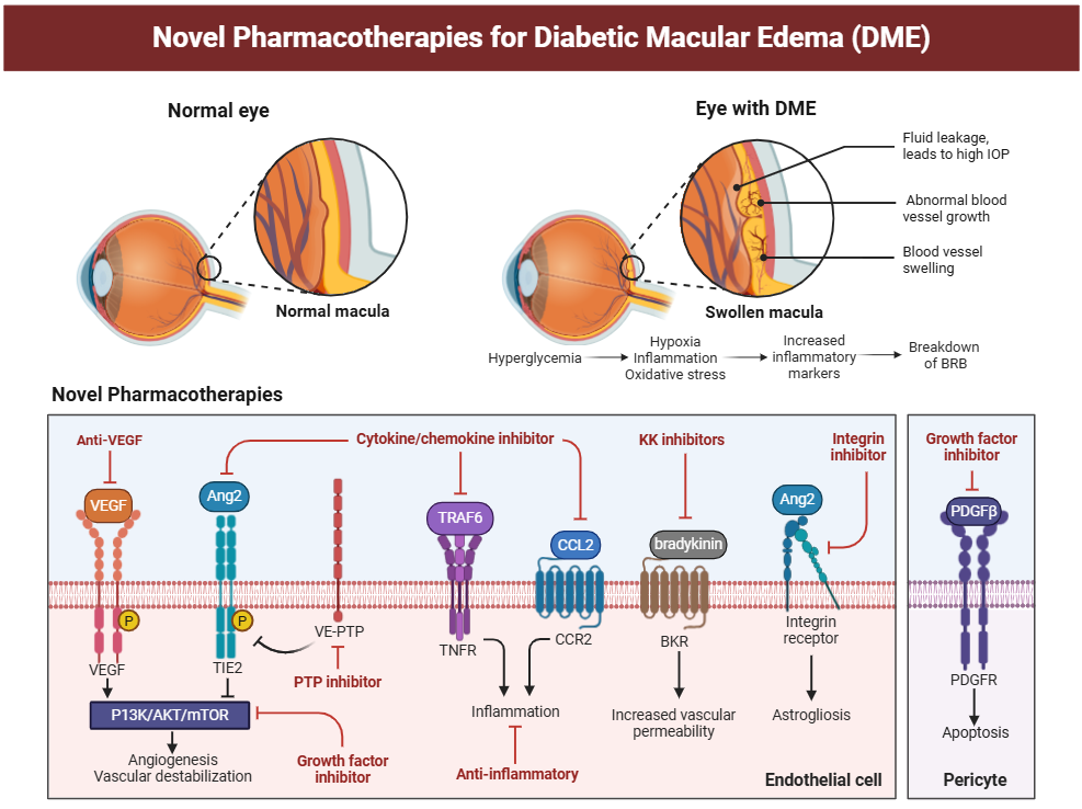 Thérapies innovantes dans l'œdème maculaire diabétique : mécanismes d'action des anti-VEGF et anticorps bispécifiques